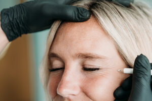 Botox-Behandlung-Falten-Aesthetiqua-Praxis-Dr.-Frey