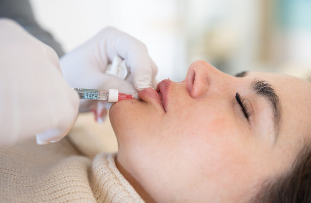 Wie viel kostet Lippen aufspritzen wirklich Aesthetiqua Ärzte klären auf