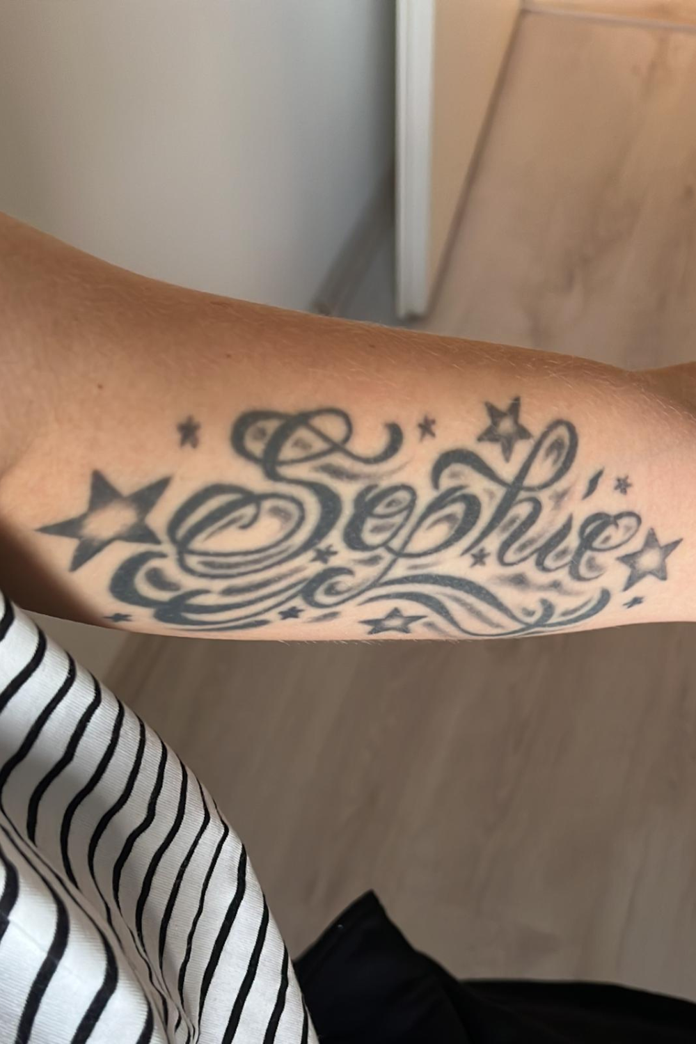 Tattooentfernung vorher nachher Pico Laser Aesthetiqua. Ergebnis Frey