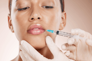 Lippen aufspritzen: 0,5 ml oder 1 ml – Was ist besser?