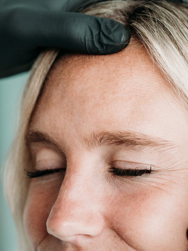 Botox-Behandlung-Falten-Aesthetiqua-Praxis-Dr.-Frey