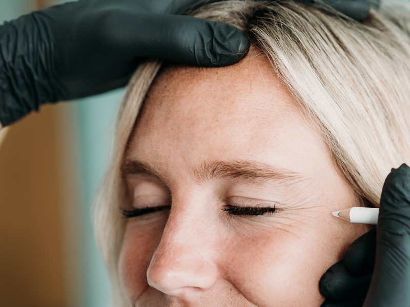 Botox-Behandlung-Falten-Aesthetiqua-Praxis-Dr.-Frey
