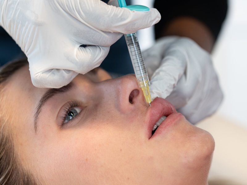 Lippen aufspritzen Filler Hyaluron Aesthetiqua