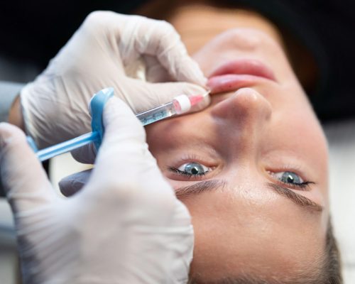 Lippen-aufspritzen-mit-Hyaluron-Behandlungsablauf-Aesthetiqua