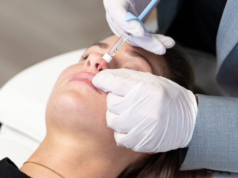 Lippenunterspritzung hyaluron Lippen aufspritzen Lippen vergrößern Aesthetiqua