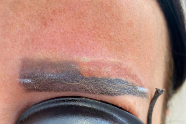 Permanent Make Up Entfernen mit dem Laser Aesthetiqua