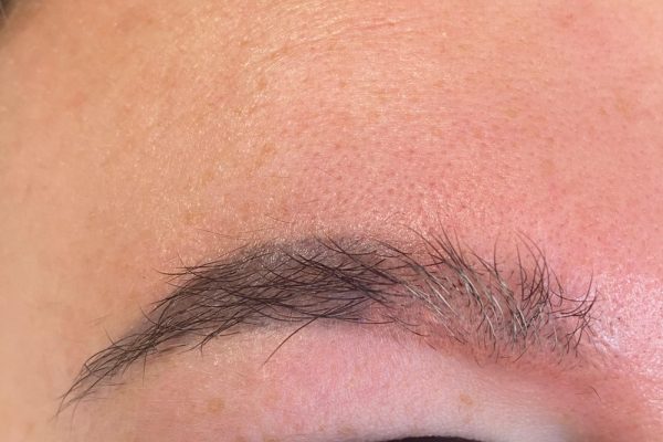 Permanent-Make-Up-entfernen-Aesthetiqua-mit-dem-Pico-Laser