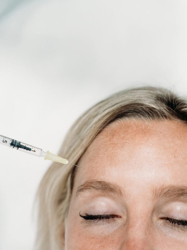 Skinnooster-Behandlung-Aesthetiqua-Hyaluron-und-Polynukleotide-Skin-Booster