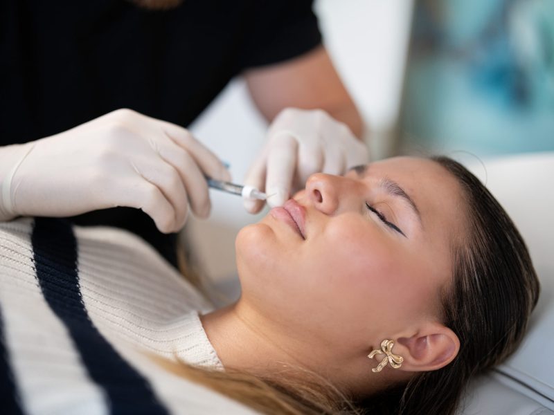 Was-darf-man-nach-dem-Lippen-aufspritzen-nicht-machen-Aesthetiqua-erklärt