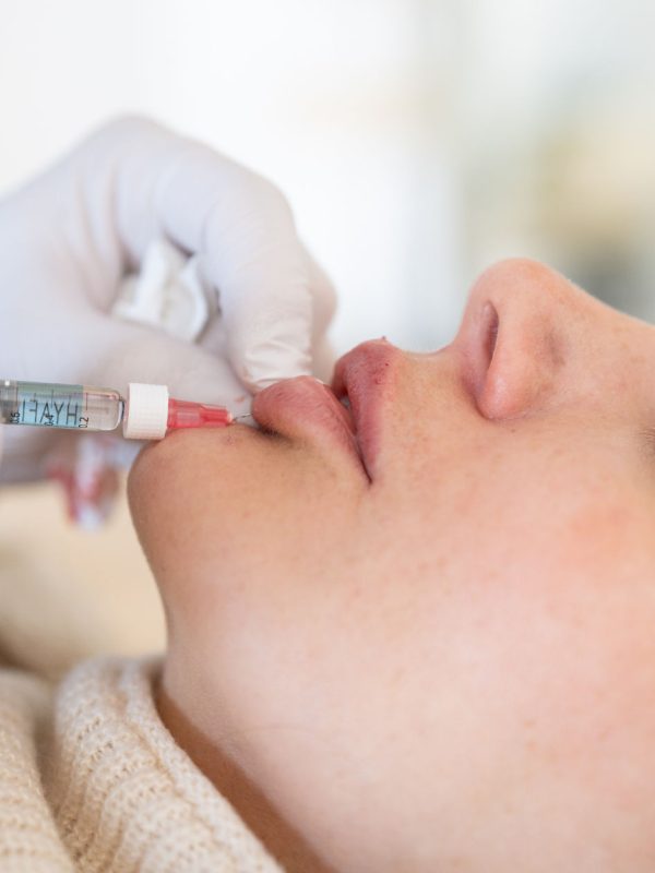 Wie viel kostet Lippen aufspritzen wirklich Aesthetiqua Ärzte klären auf Wie viel kostet Lippen aufspritzen wirklich Aesthetiqua Ärzte klären auf