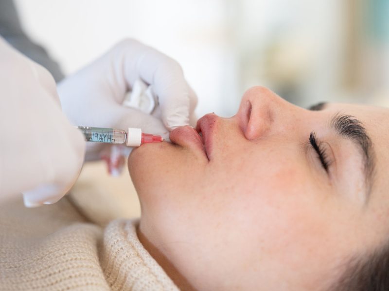 Wie viel kostet Lippen aufspritzen wirklich Aesthetiqua Ärzte klären auf