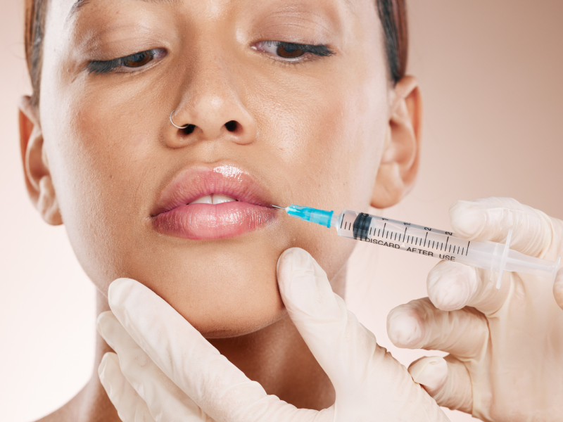 Lippen aufspritzen: 0,5 ml oder 1 ml – Was ist besser?